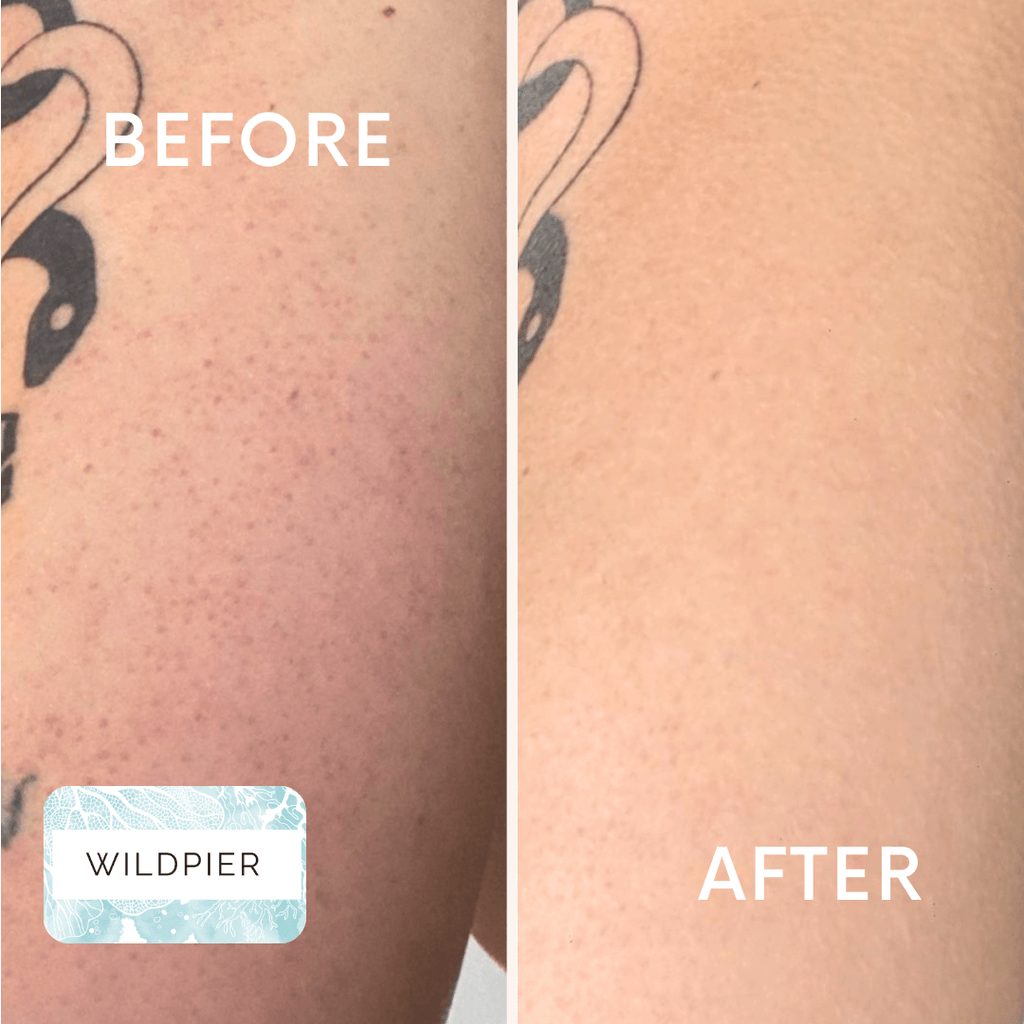 Wildpier™ Deep Exfoliating Glove