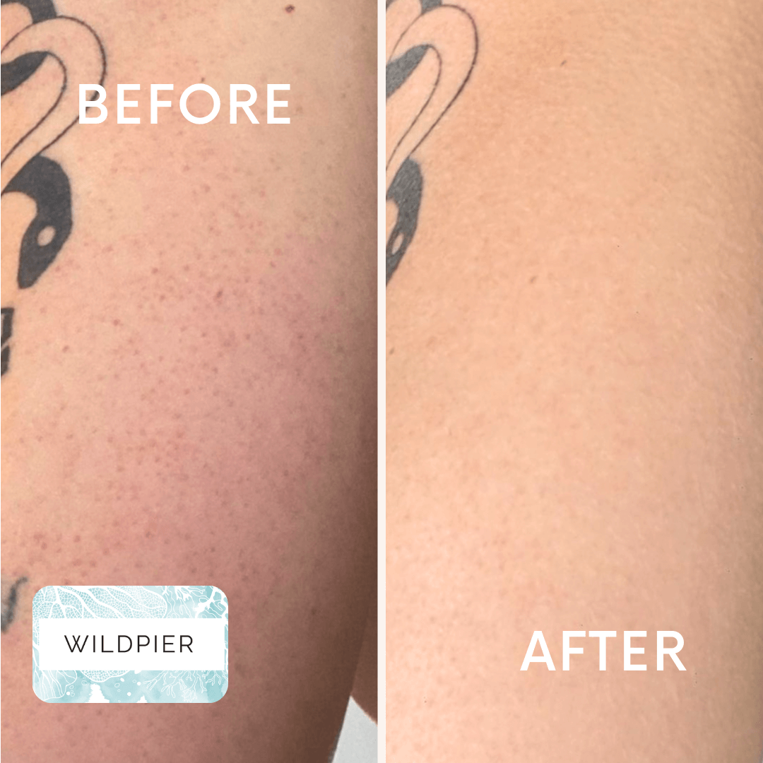 Wildpier™ Deep Exfoliating Glove