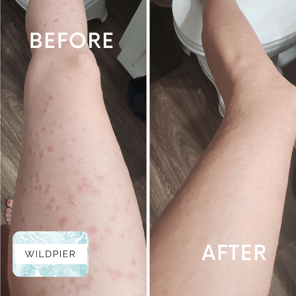 Wildpier™ Deep Exfoliating Glove