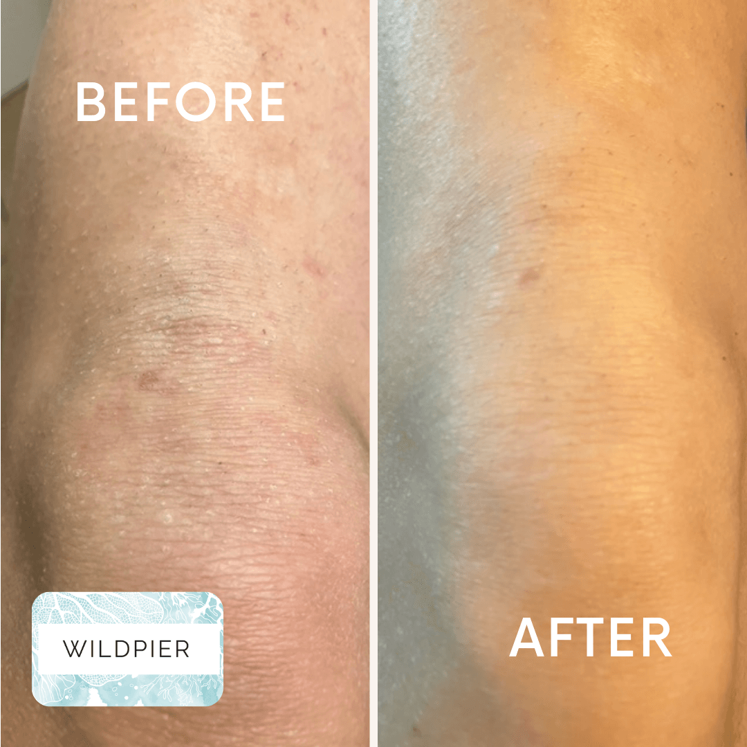 Wildpier™ Deep Exfoliating Glove